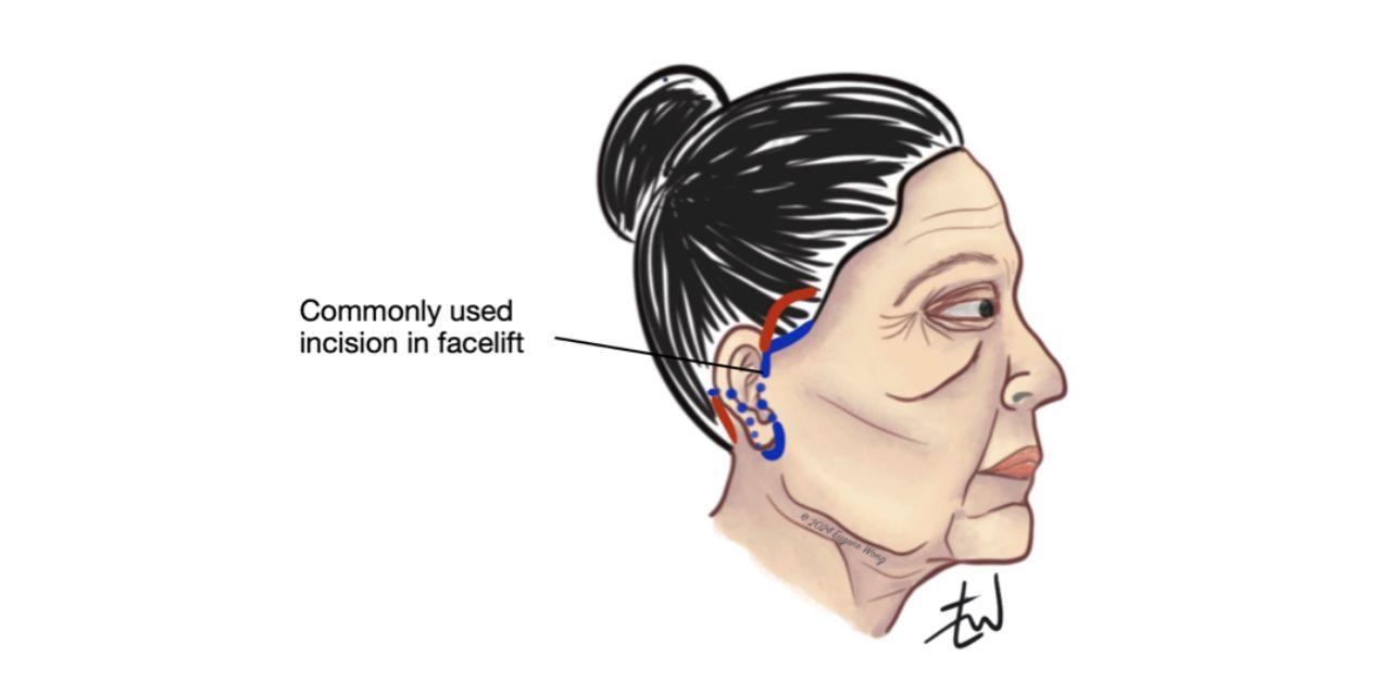 evolution facial rejuvination professor alwyn dsouza