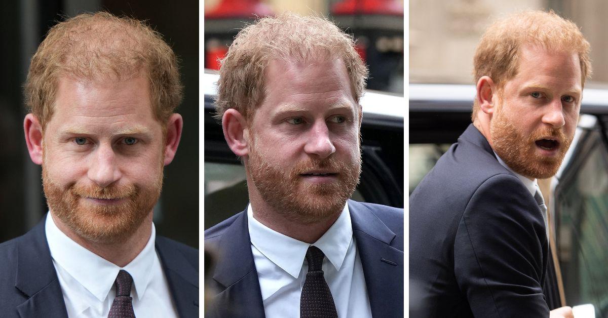Prince Harry's Thinning Hair Suddenly Appears Thicker In Recent Photos