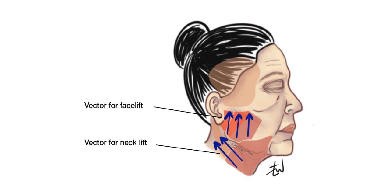 evolution facial rejuvination professor alwyn dsouza